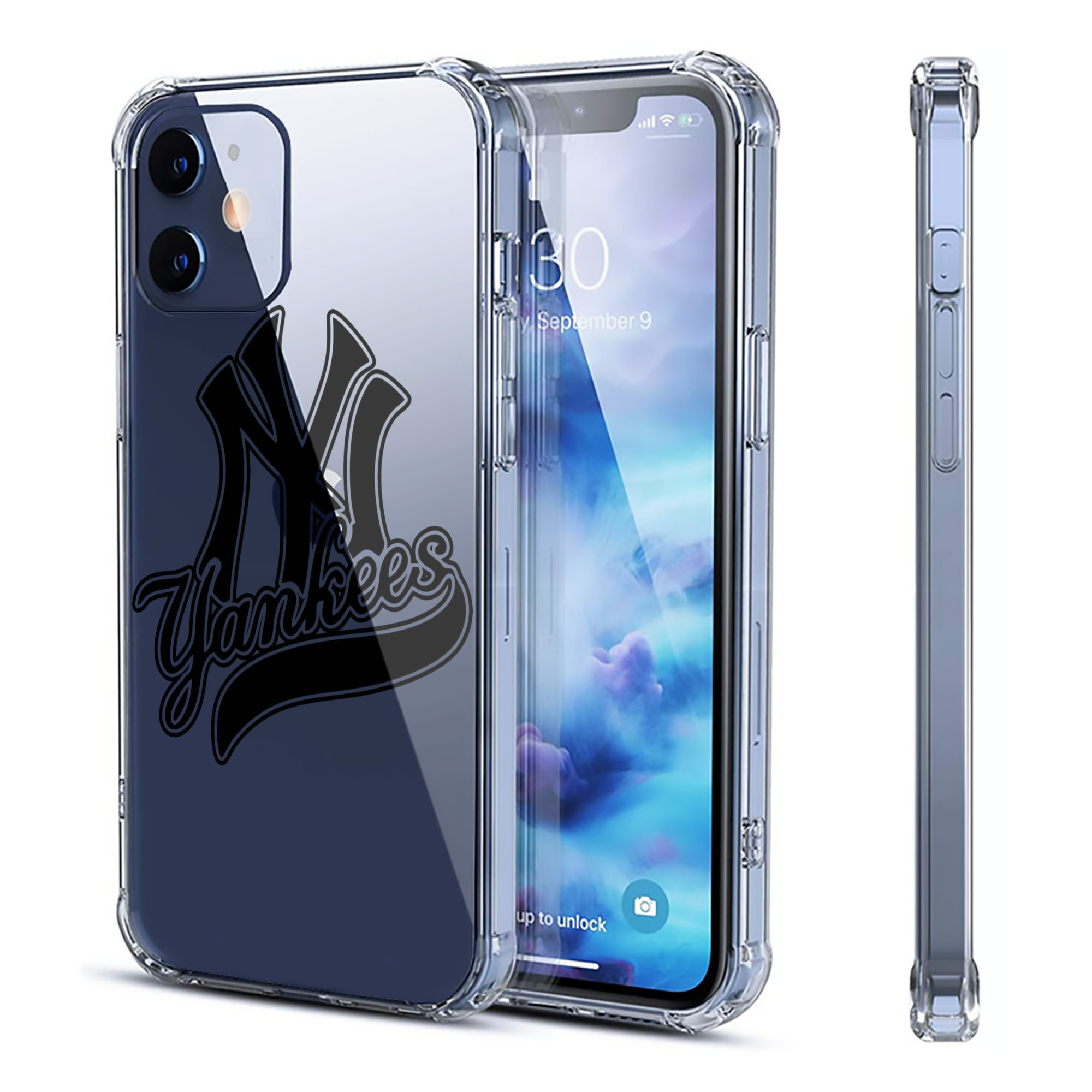 New York Yankees Black Logo Clear IPhone 12 Case – Soft TPU With UV Print – Enhanced Drop Protection, Precise Fit, Anti-Fingerprint, Customizable Design, Scratch-Resistant, Yellow-Resistant